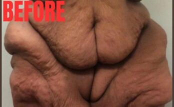 World’s heaviest woman who weighed 50 stone and gorged on milkshakes now unrecognisable